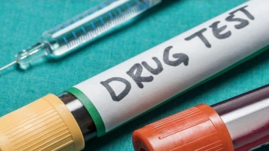 How to Prepare for a weed Drug Test Dos and Don’ts All About Life