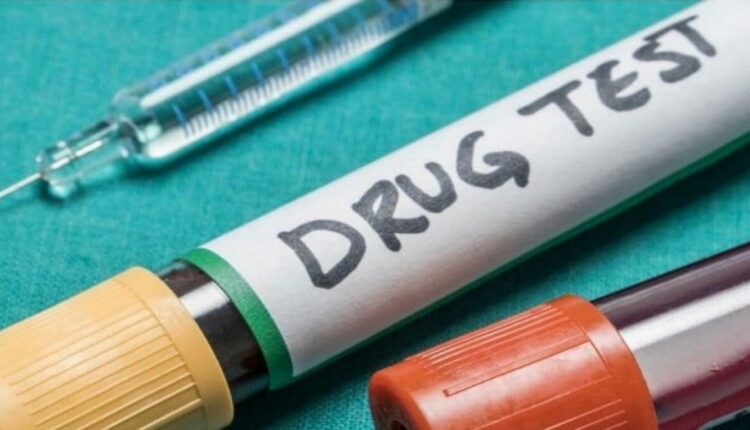 How to Prepare for a weed Drug Test Dos and Donts